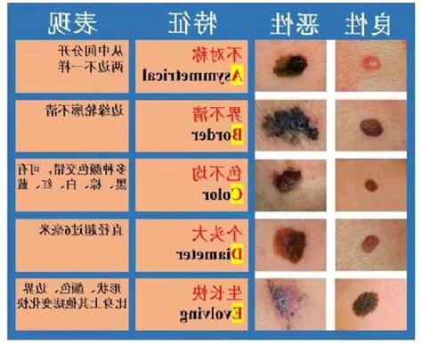 陰囊 黑痣